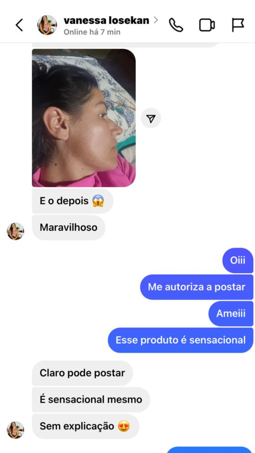 depoimento melasma