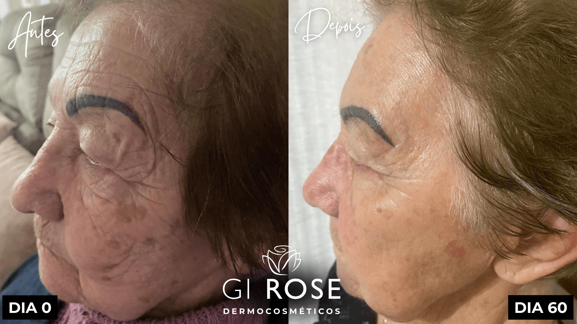 tratamento de pele gi rose (1)