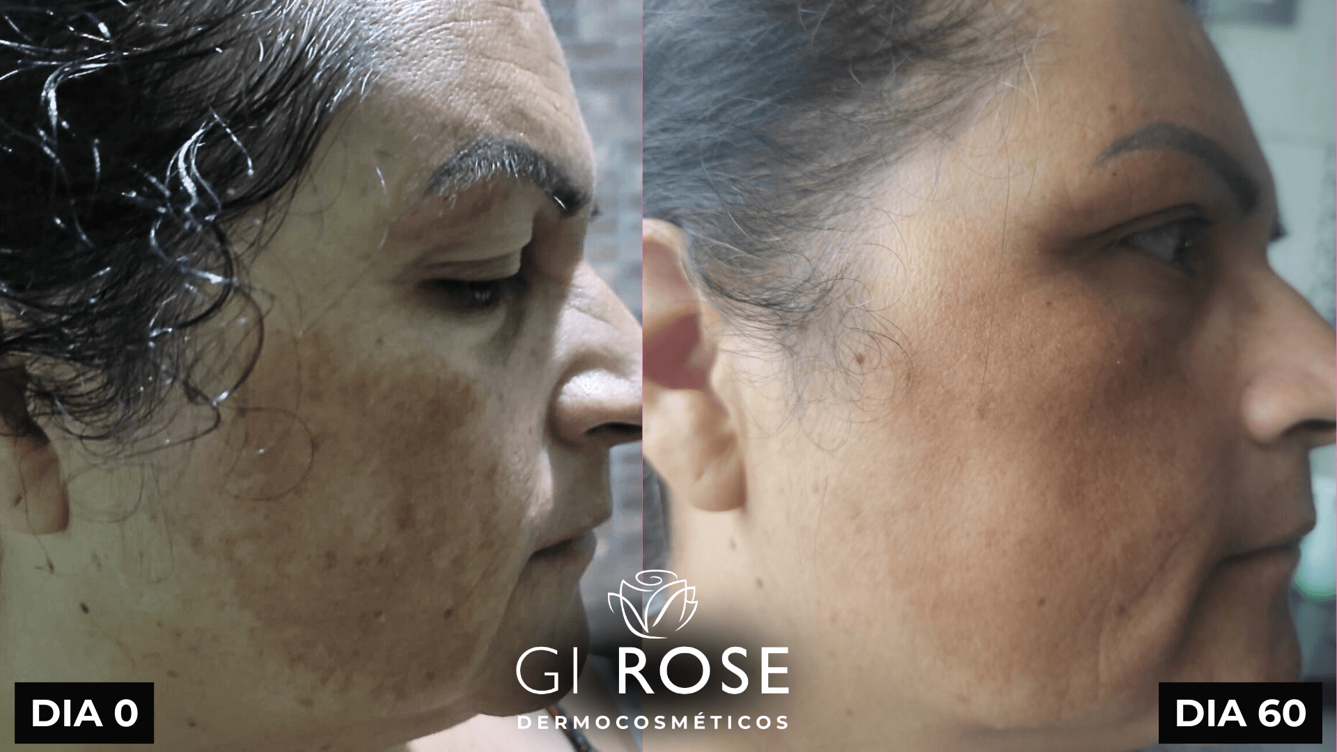 tratamento de pele gi rose (10)