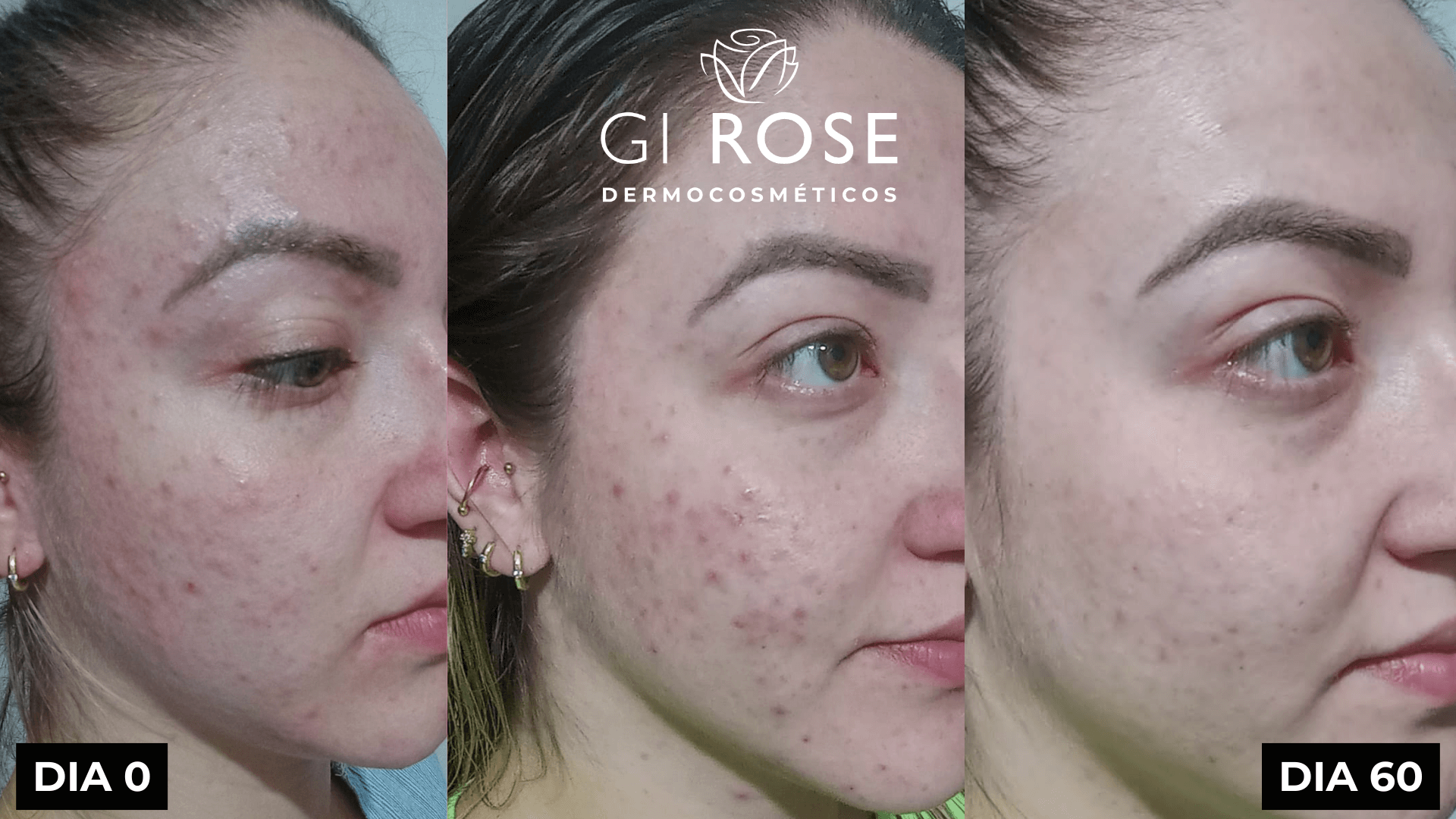 tratamento de pele gi rose (2)
