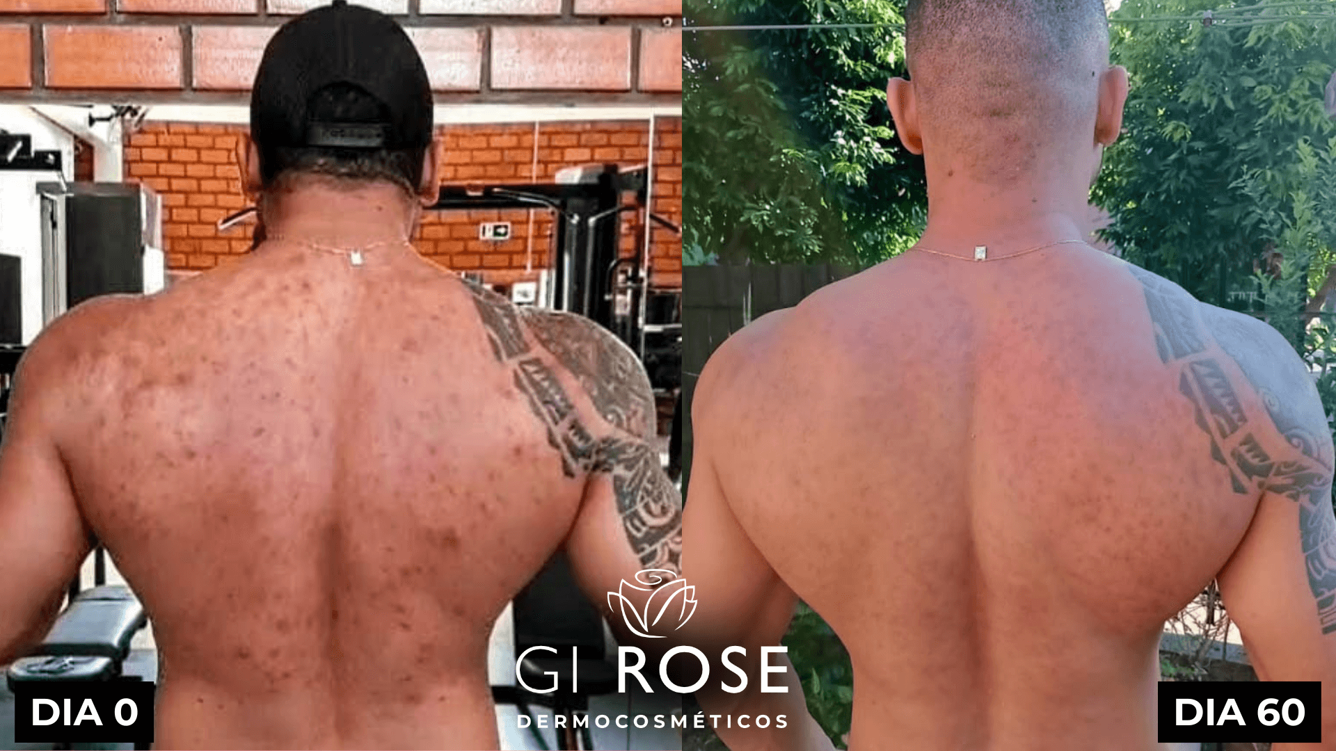 tratamento de pele gi rose (5)
