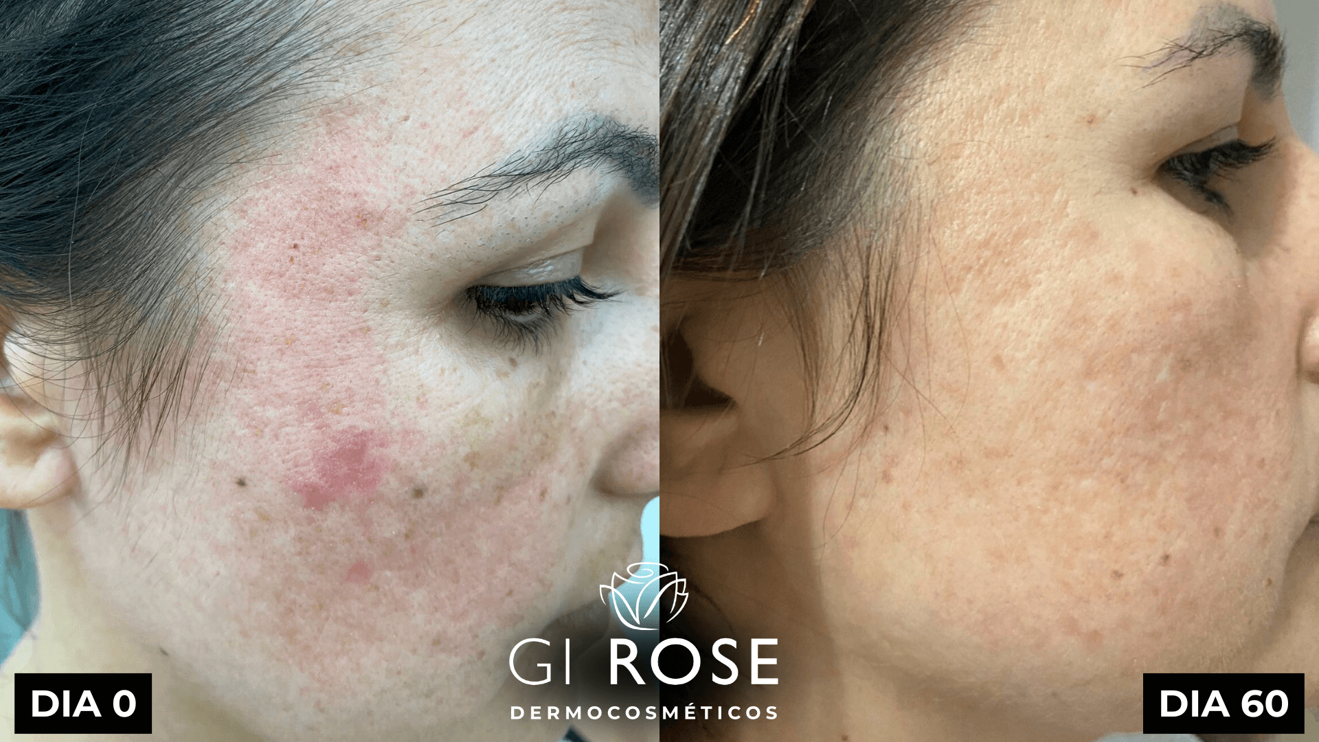 tratamento de pele gi rose (6)