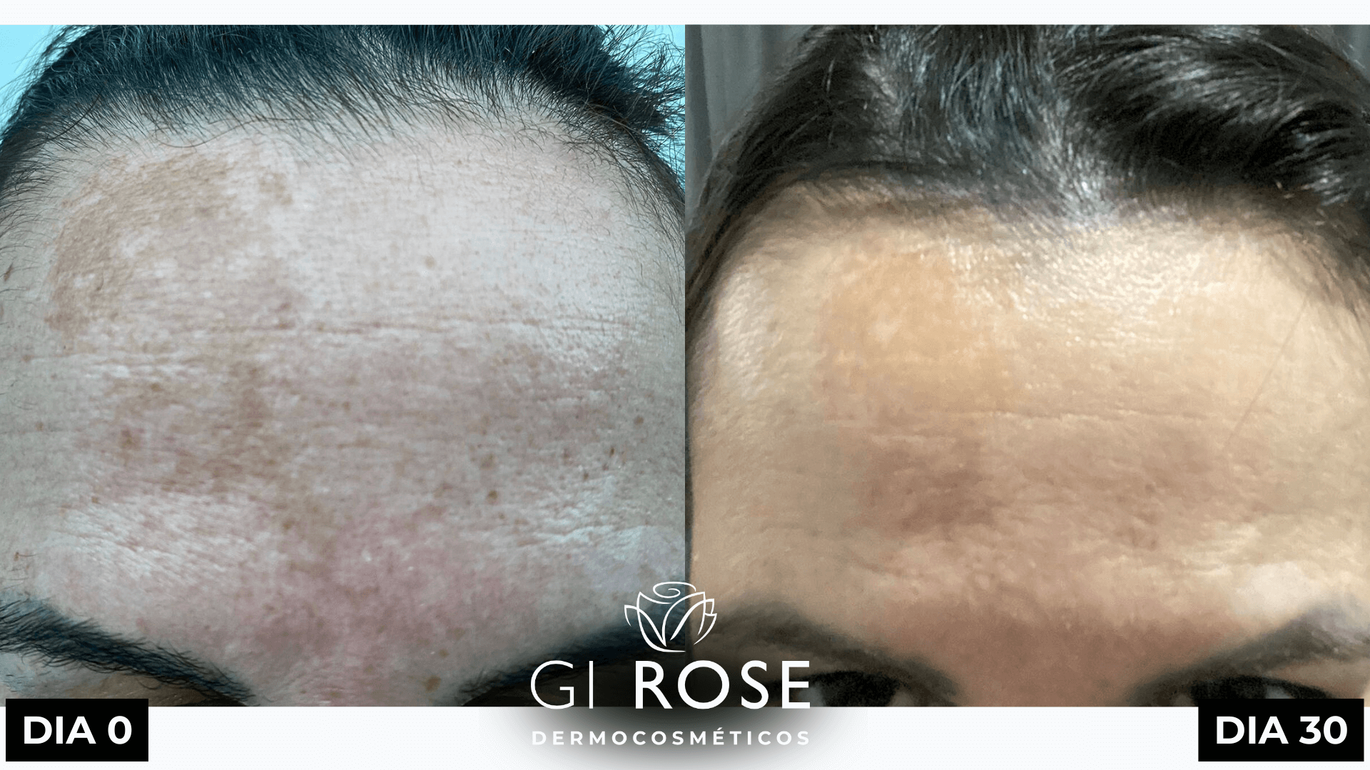 tratamento de pele gi rose (7)