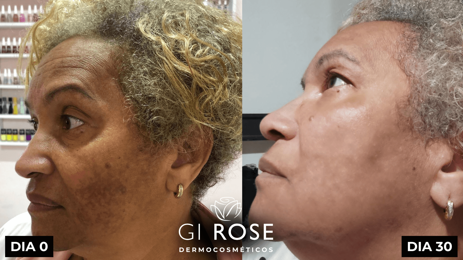 tratamento de pele gi rose (8)