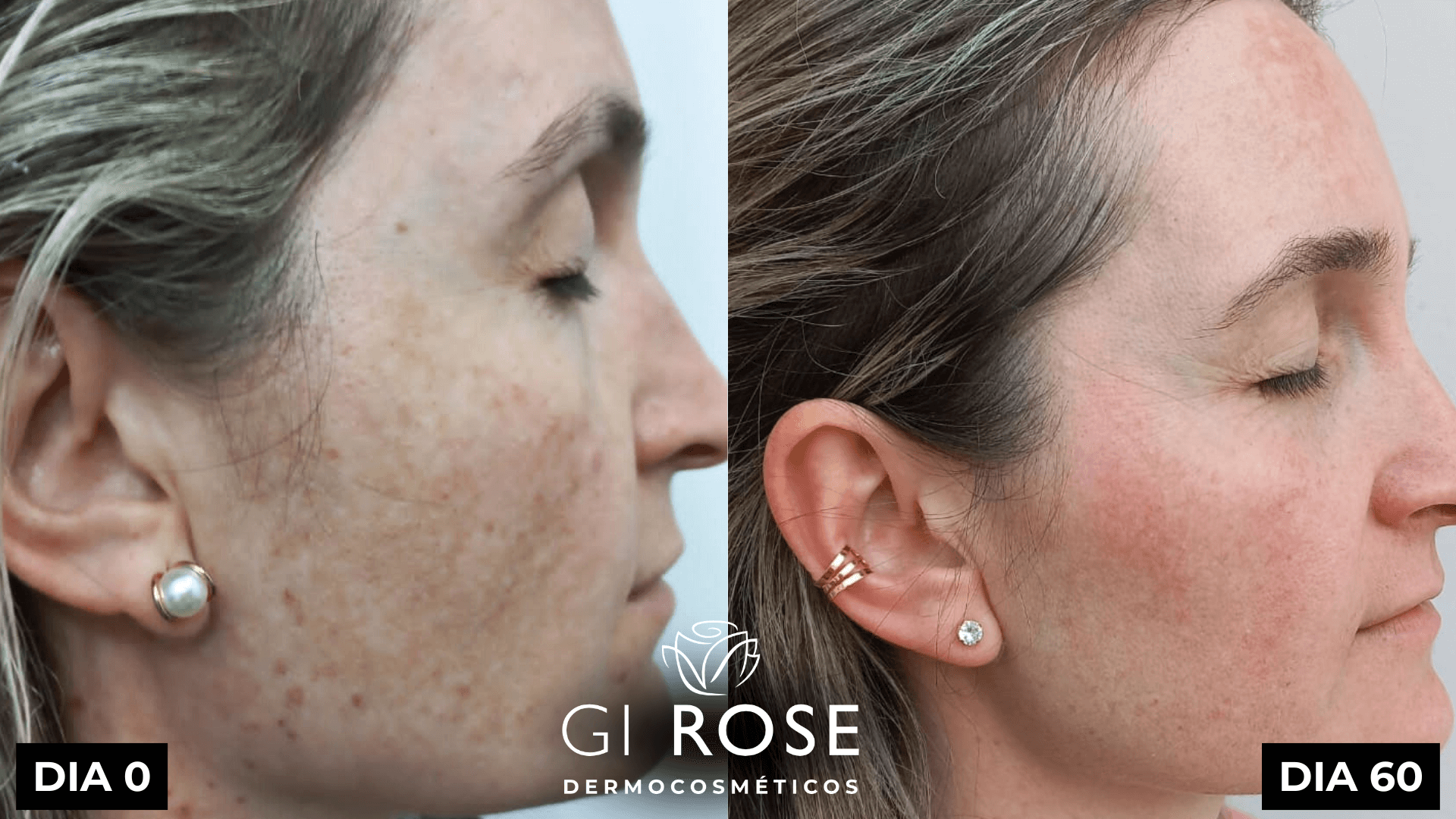 tratamento de pele gi rose (9)